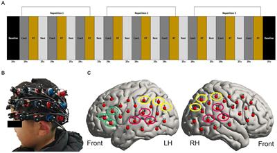 Cortical responses correlate with speech performance in pre-lingually deaf cochlear implant children